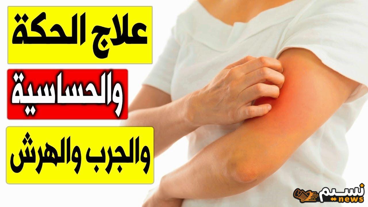 استكشف أفضل العلاجات المنزلية الطبيعية لتخفيف الحكة وتهدئة الالتهابات الجلدية.. حلول فعّالة وملطفة لبشرة صحية ومريحة